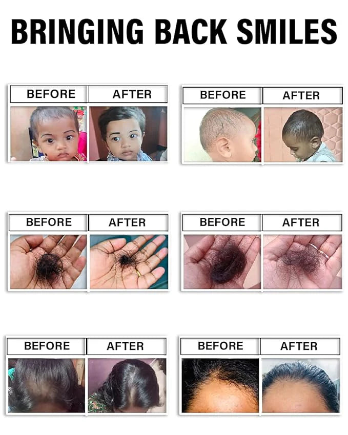 PIMPOM PAATI HAIR OIL